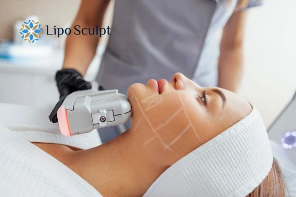 HIFU vs Botulinum Toxin: Understanding the Differences 1 HIFU vs Botox Hitchin What is the best option for you?