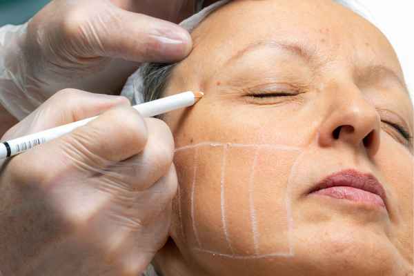 CryoPen: 5 Skin Concerns It May Be Used to Treat 4 What should you ask before having CryoPen treatment Hitchin?