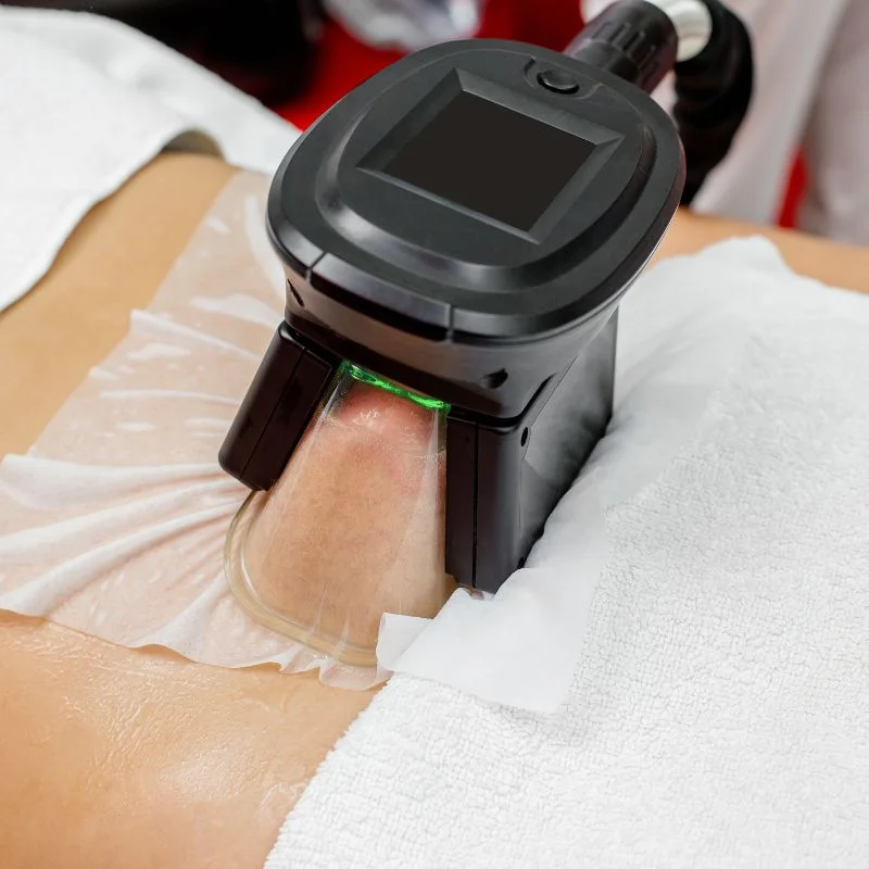 Fat Freezing treatment Hitchin